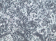 SNU-398;人肝癌细胞【已通过STR鉴定】