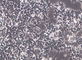 2V6.11人胚肾细胞【已通过STR鉴定】