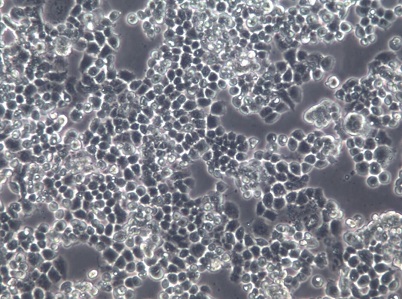 COV434;人卵巢颗粒肿瘤细胞【已通过STR鉴定】