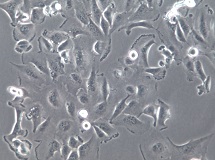 SNU423;人肝癌细胞【已通过STR鉴定】