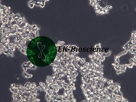 WERI-Rb-1人视网膜神经胶质瘤细胞【已通过STR鉴定】