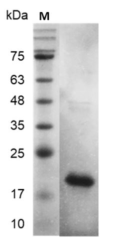 Fig.Human FGF-1 Protein, His tag (Animal-Free)