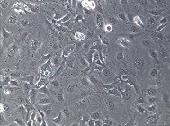 MDA-MB-157人乳腺癌细胞【已通过STR鉴定】