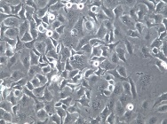 HCC1806;人乳腺癌细胞【已通过STR鉴定】