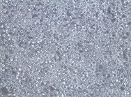 OCI-AML3;人急性髓系白血病细胞【已通过STR鉴定】