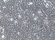 SW837人直肠腺癌细胞【已通过STR鉴定】