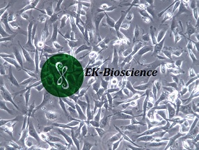 HS-5;人骨髓基质细胞【已通过STR鉴定】