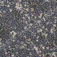 HCT-116；人结肠癌细胞 (STR)