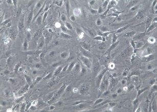 HMEC-1;人微血管内皮细胞株【已通过STR鉴定】