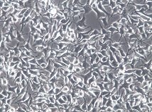 92-1;人葡萄膜黑色素瘤细胞【已通过STR鉴定】