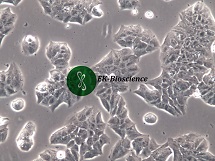 MDA-MB-361;人乳腺癌细胞【已通过STR鉴定】