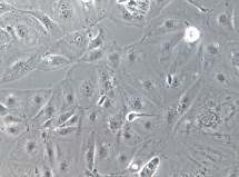 MKN-7;人胃癌细胞【已通过STR鉴定】