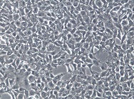 PA-1人卵巢畸胎瘤细胞【已通过STR鉴定】