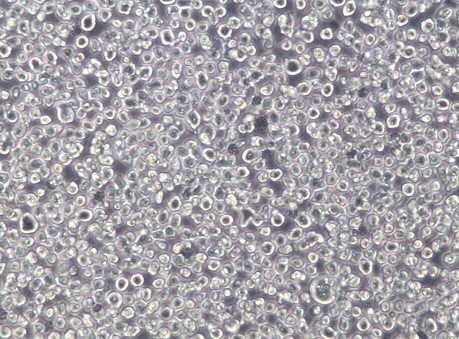 AMO-1;人骨髓浆细胞瘤【已通过STR鉴定】