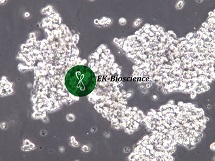 NCI-H69、H69;人小细胞肺癌细胞【已通过STR鉴定】