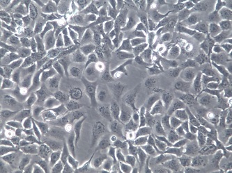 NCI-H2009;人肺腺癌细胞【已通过STR鉴定】