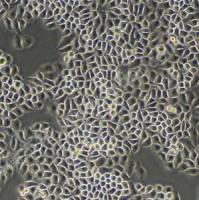 Hela；人宫颈癌细胞 (STR)