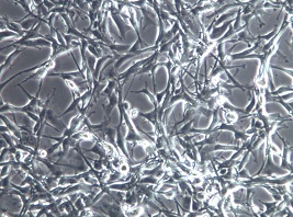 U-87MG（U87MG）人脑星形胶质母细胞瘤细胞【已通过STR鉴定】