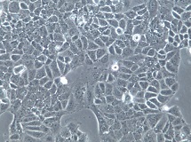 OV-90;人卵巢癌细胞【已通过STR鉴定】