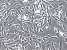 SNU-449、SNU449;人肝癌细胞【已通过STR鉴定】