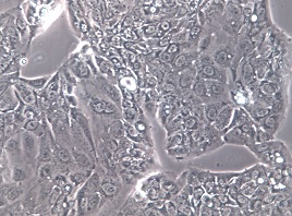 HPAF-II;人胰腺癌细胞【已通过STR鉴定】