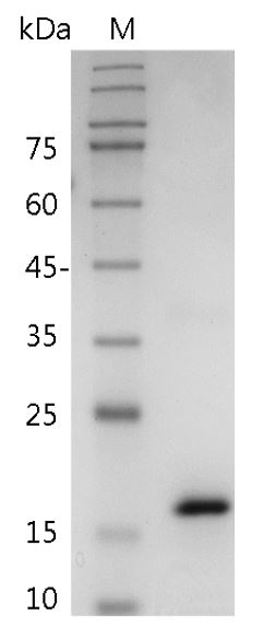 Fig.Human IL-36γ Protein, His tag (Animal-Free)