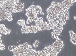 ZR-75-1人乳腺癌细胞【已通过STR鉴定】