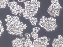 NCI-H524人小细胞肺癌细胞【已通过STR鉴定】