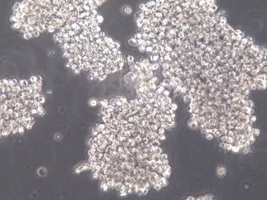 OCI-LY3人弥漫大B细胞淋巴瘤细胞【已通过STR鉴定】