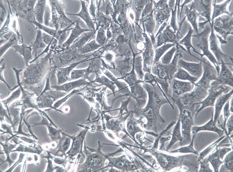 MP46;人眼葡萄膜黑色瘤細胞【已通过STR鉴定】