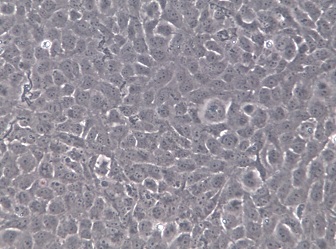 SRA01/04(HLE)人晶体上皮细胞永生系 【已通过STR鉴定】