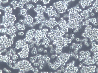 WSU-DLCL-2;人弥漫大B淋巴瘤细胞【已通过STR鉴定】