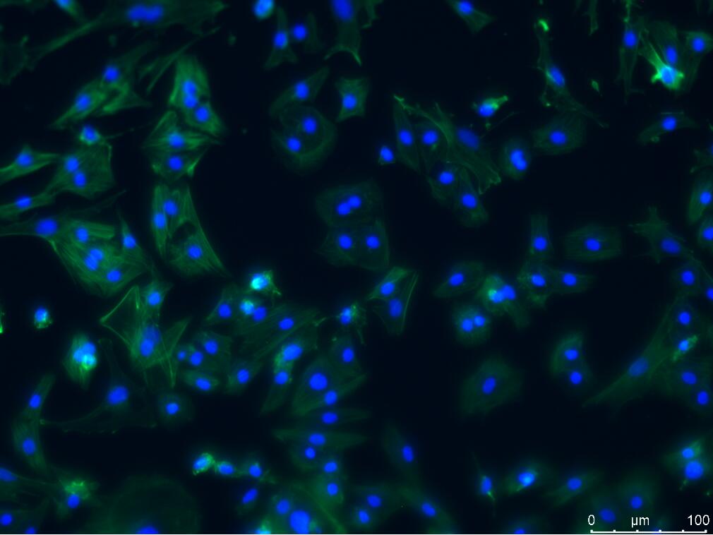 Fig.1 该图是原代细胞培养的小鼠心肌细胞。
