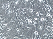 HS746T 人胃癌细胞【已通过STR鉴定】