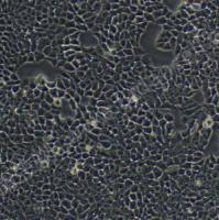 MCF-7;人乳腺癌细胞 (STR)