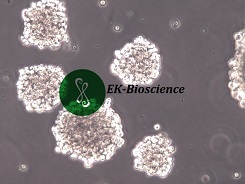 NK-92MI [NK92MI]人恶性非霍奇金淋巴瘤患者的自然杀伤细胞【已通过STR鉴定】