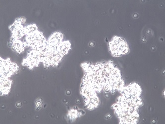 DMS153人小细胞肺癌细胞【已通过STR鉴定】