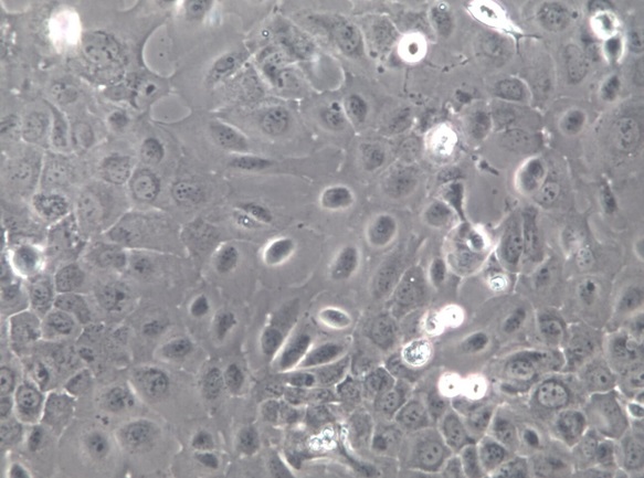 SCC-9;人舌鳞癌细胞【已通过STR鉴定】