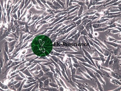 HS683;人脑胶质瘤细胞【已通过STR鉴定】