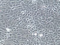 SAS;人舌头鳞状肿瘤细胞【已通过STR鉴定】