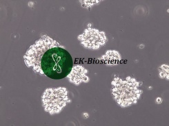 NK-92 [NK92]人恶性非霍奇金淋巴瘤患者的自然杀伤细胞【已通过STR鉴定】