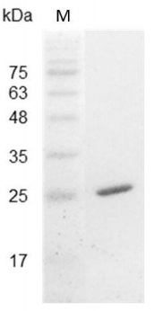 重组小鼠白介素-30，His-标签（无动物源）（IL-30）