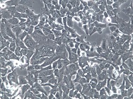 HCC1954;人乳腺癌细胞【已通过STR鉴定】