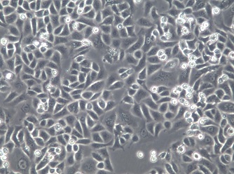 G-401、G401人肾癌Wilms细胞【已通过STR鉴定】