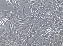 SW982;人滑膜肉瘤细胞【已通过STR鉴定】