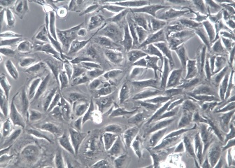 NCI-H28;人间皮瘤细胞【已通过STR鉴定】