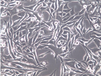 HMY-1;人黑色素瘤细胞【已通过STR鉴定】