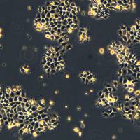 人咽鳞癌顺铂耐药株