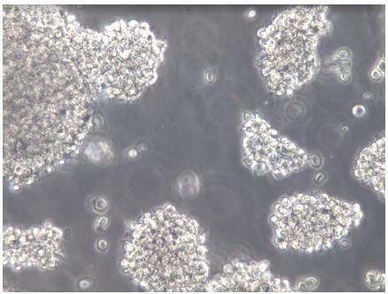 GM12878;人B淋巴细胞【已通过STR鉴定】