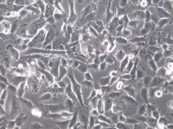 MOG-G-UVW;人脑星形胶质细胞瘤细胞【已通过STR鉴定】